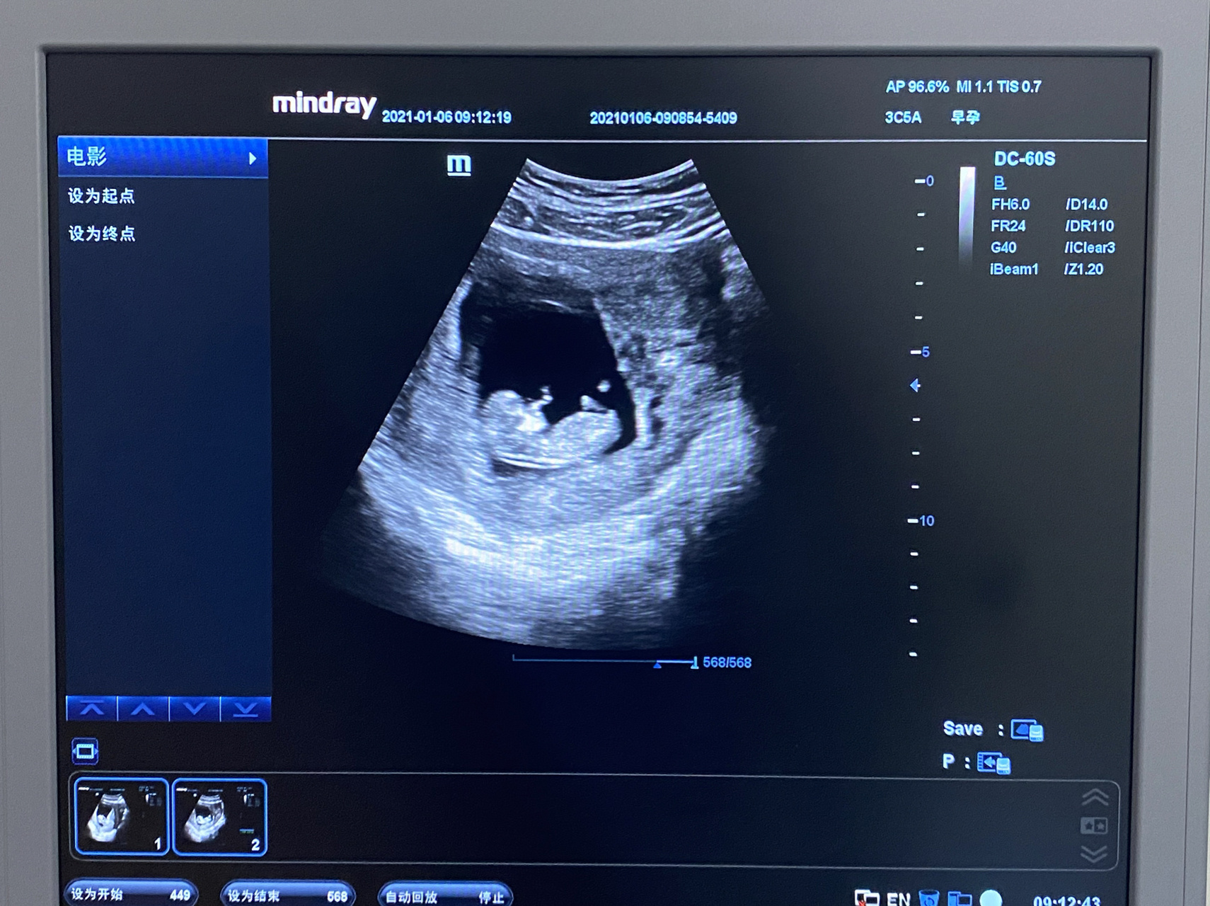 孕十一周整的小宝宝 早上去b超,宝宝还在肚子里睡觉,小手摸着自己的脸