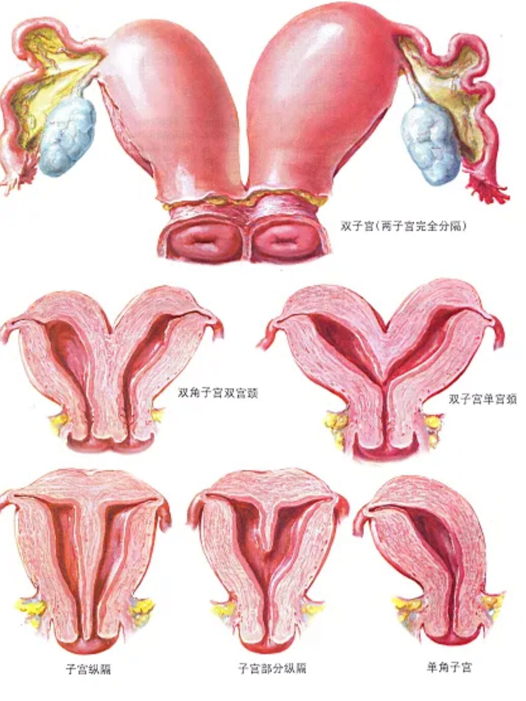 残角子宫外观描述图片