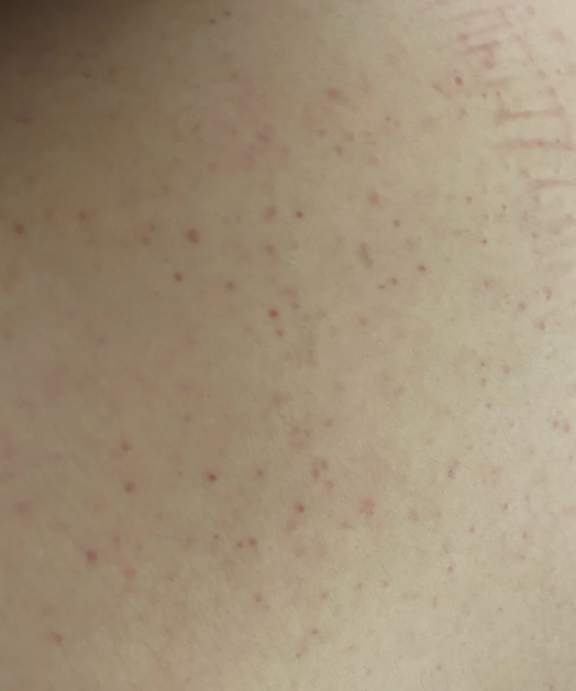 为什么会长红点