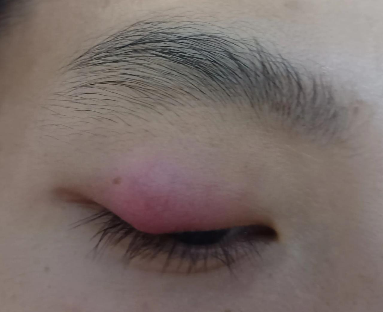 天天看手机,玩电脑,眼睛轻微有点红肿,有个把星期了.