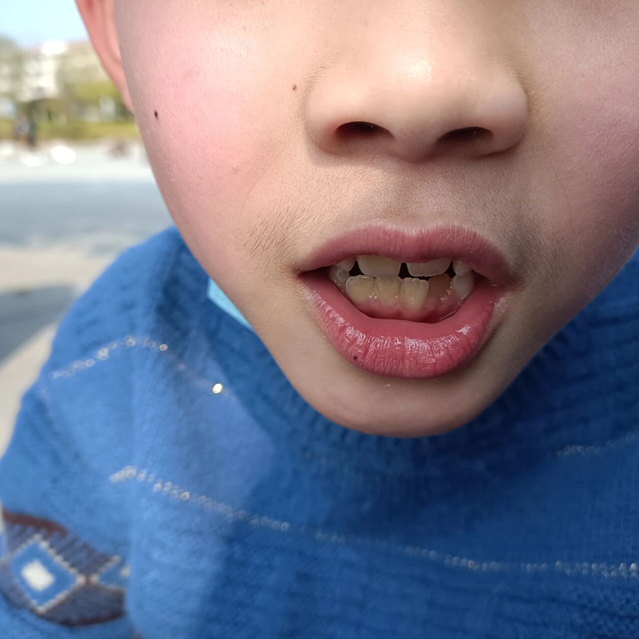 7岁,就长这么明显的胡子了,怎么办哦?好害怕影响他的身心健康