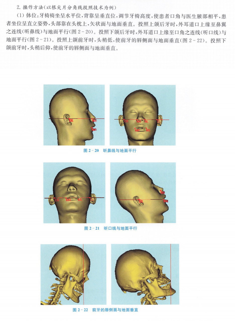 小牙片拍摄下颌牙齿投照角度图谱