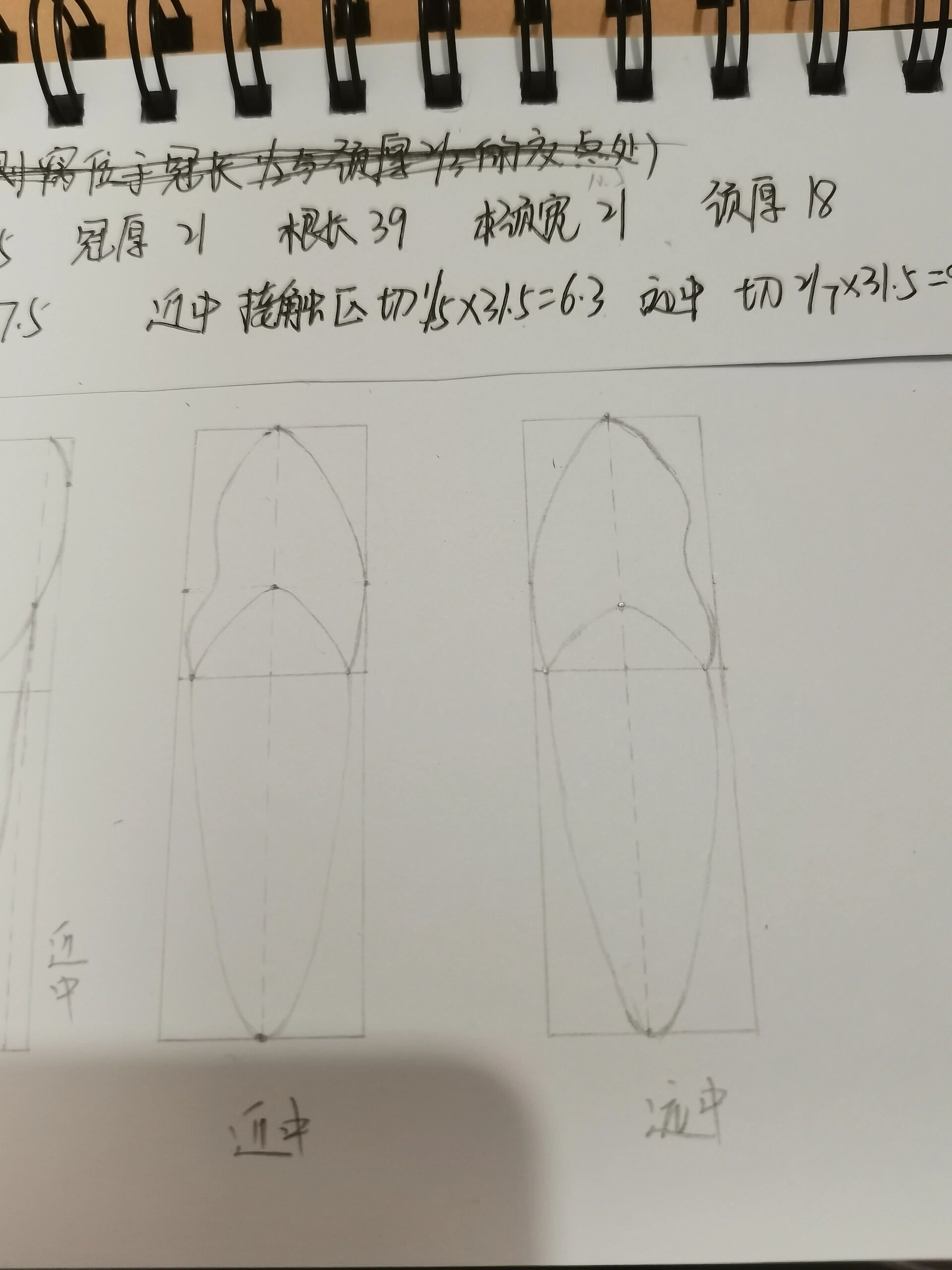 上颌中切牙3倍大画图图片