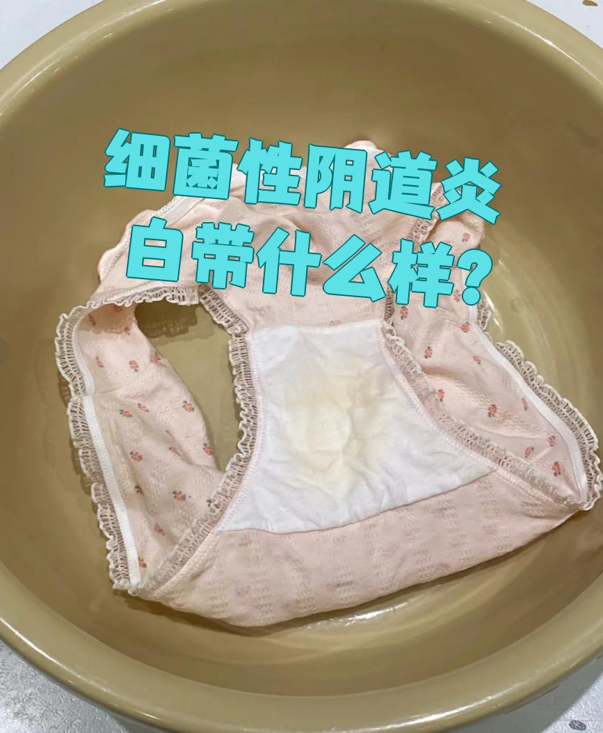 细菌性阴道炎白带什么样?