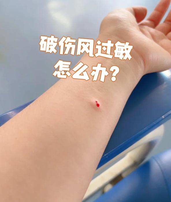 破伤风过敏怎么办?