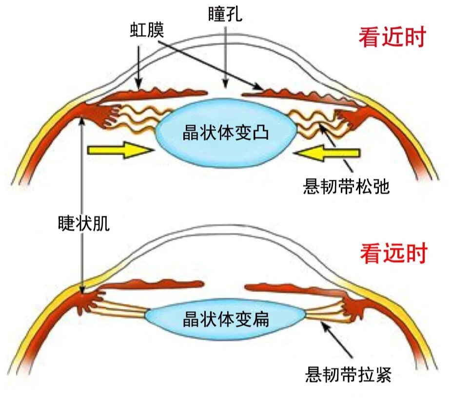 阿托品散瞳的正确图解图片