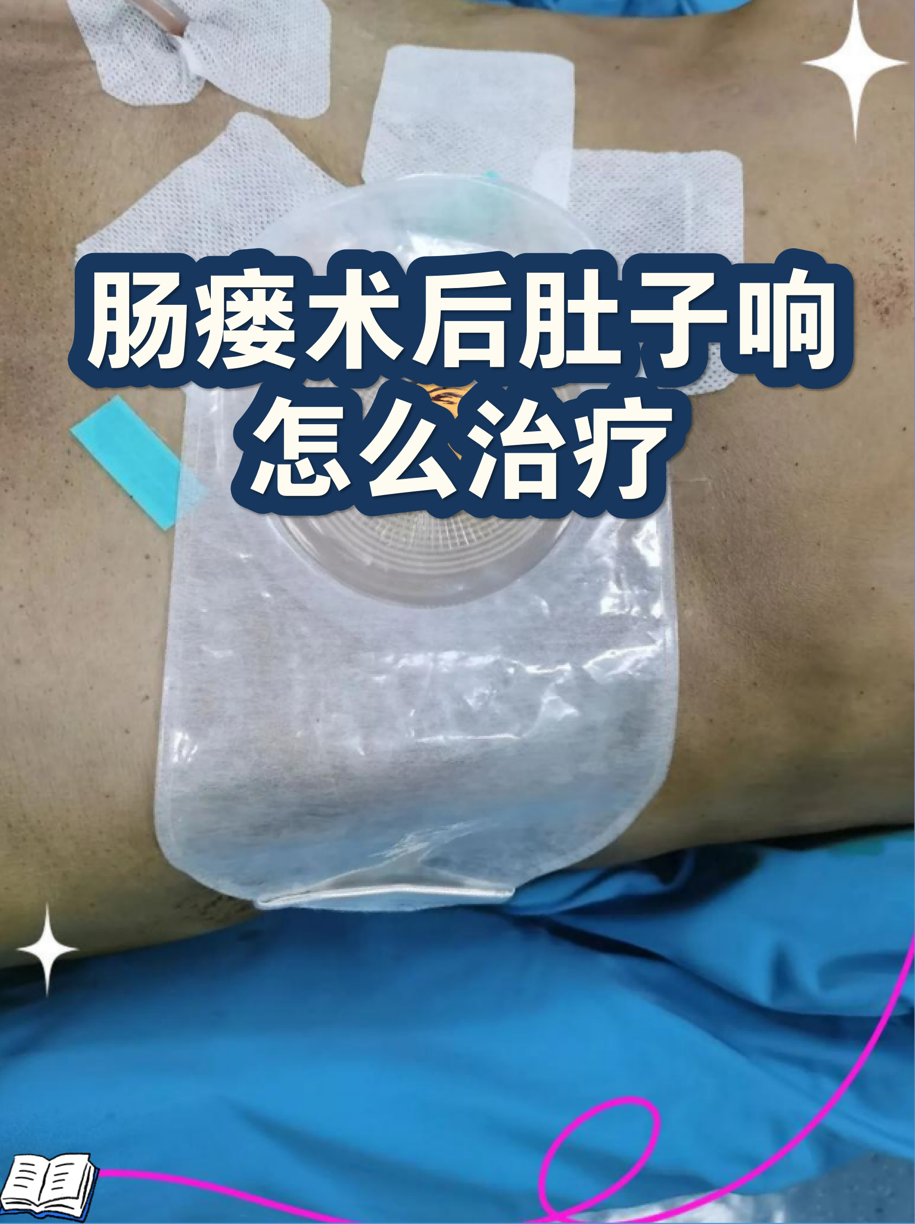 中国医学科学院阜外医院预约挂号陪诊一体术后康复全程跟踪，恢复不走弯路的简单介绍