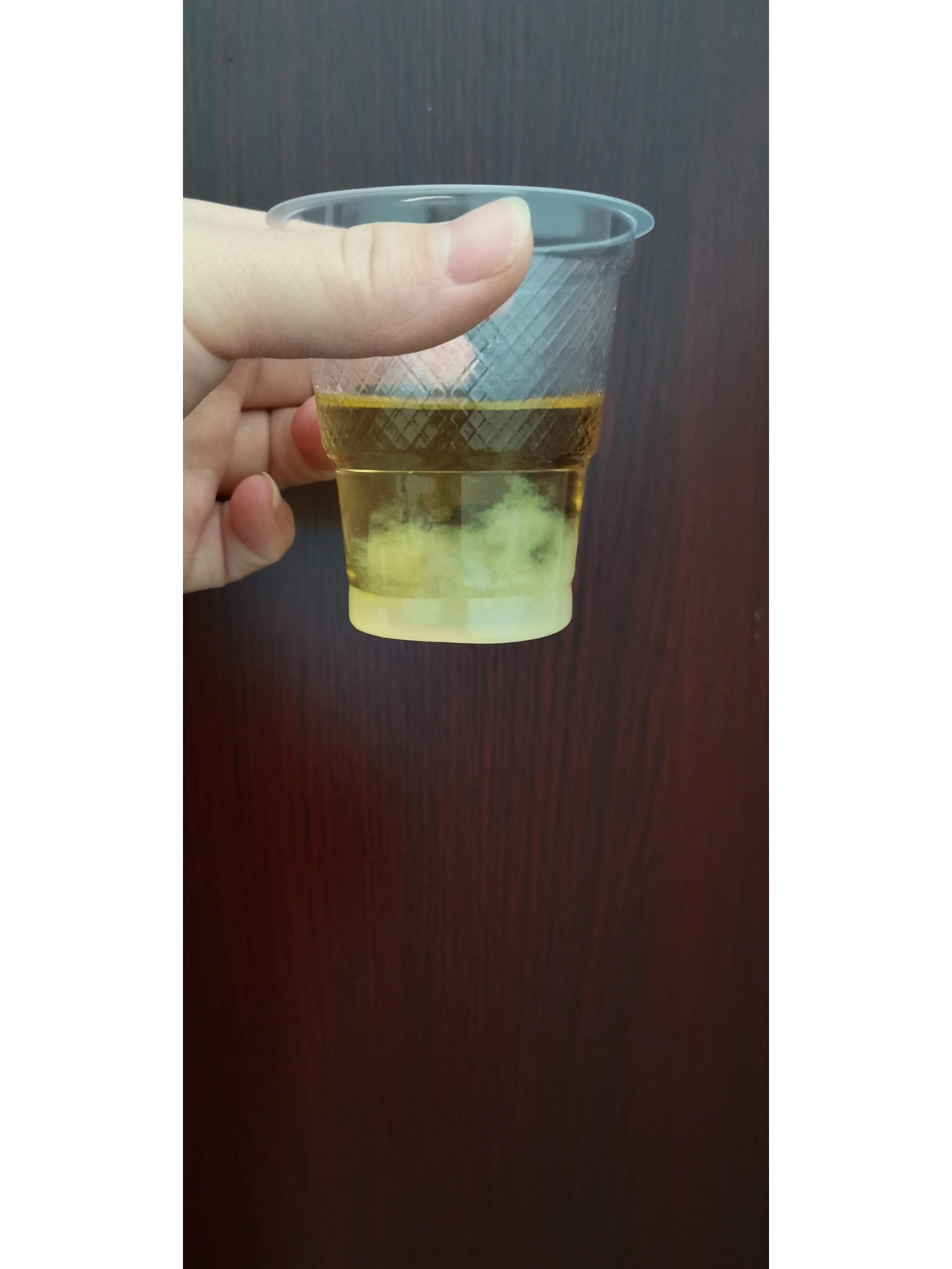 晨尿测男女准吗?
