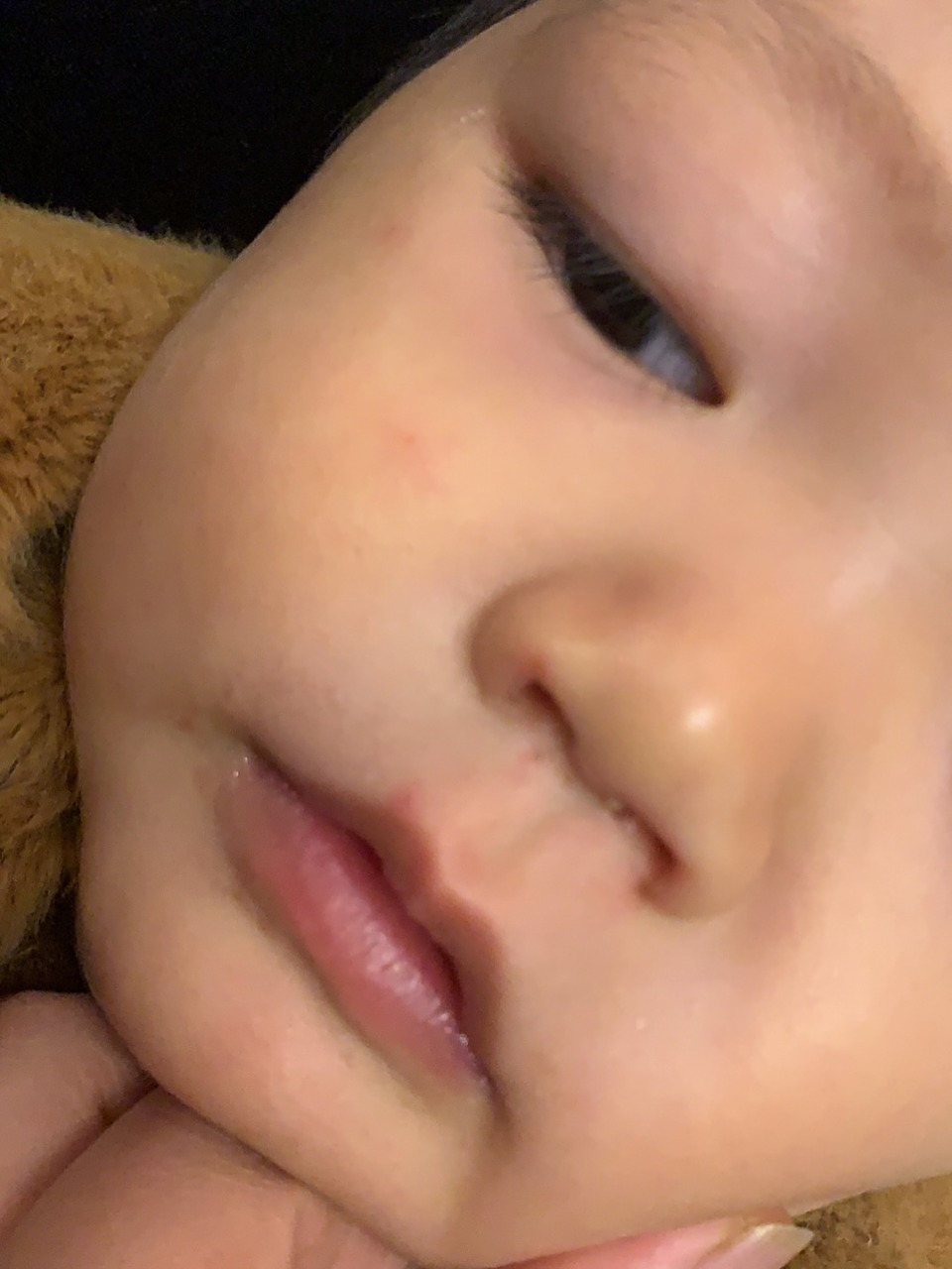 确诊轻微手足口前期症状: 1,宝宝前一天出去玩坐车1.