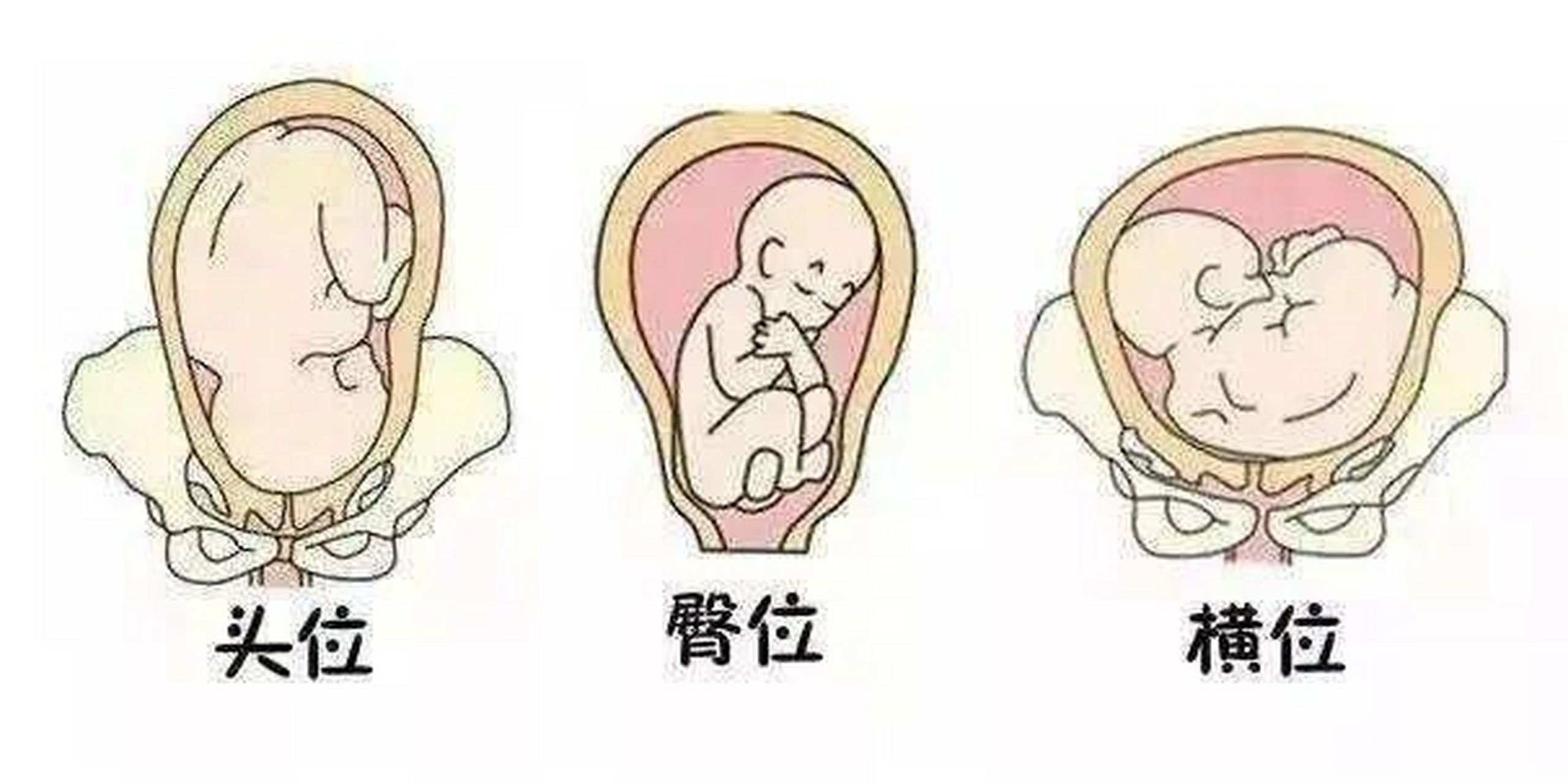 一图看懂胎方位 胎方位是指先露部的指示点与产妇骨盆的关系