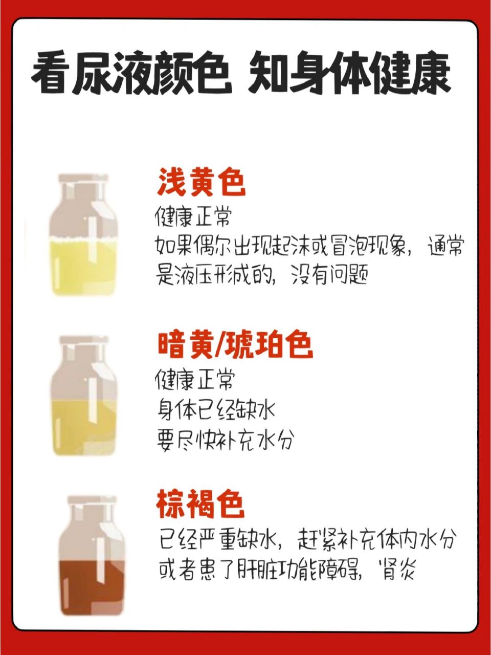 尿完先别冲,快看看你的尿液颜色