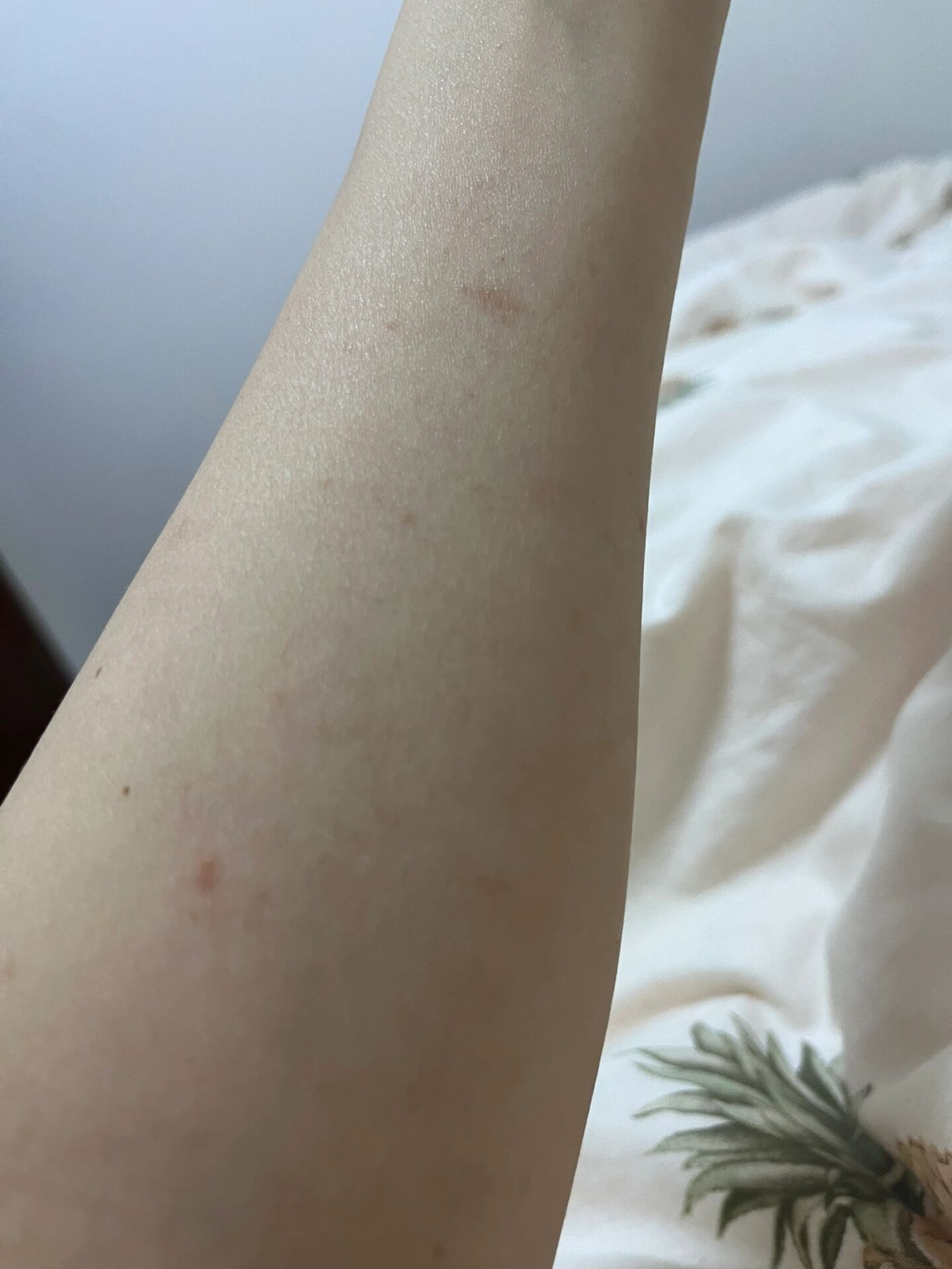 手臂上突然冒出很多小红点