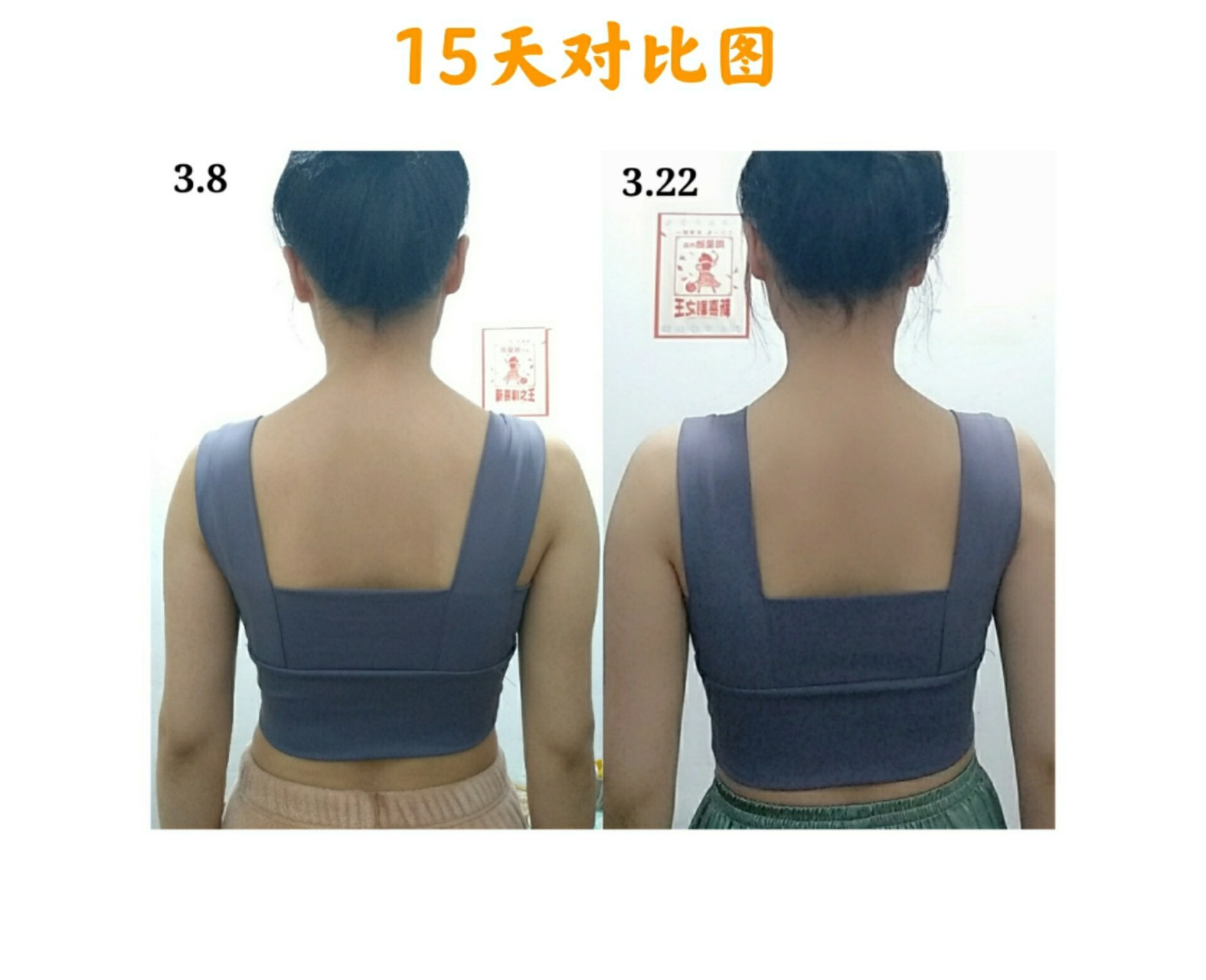 驼背改善‖15天对比图来啦! 打卡改善驼背的第15天!