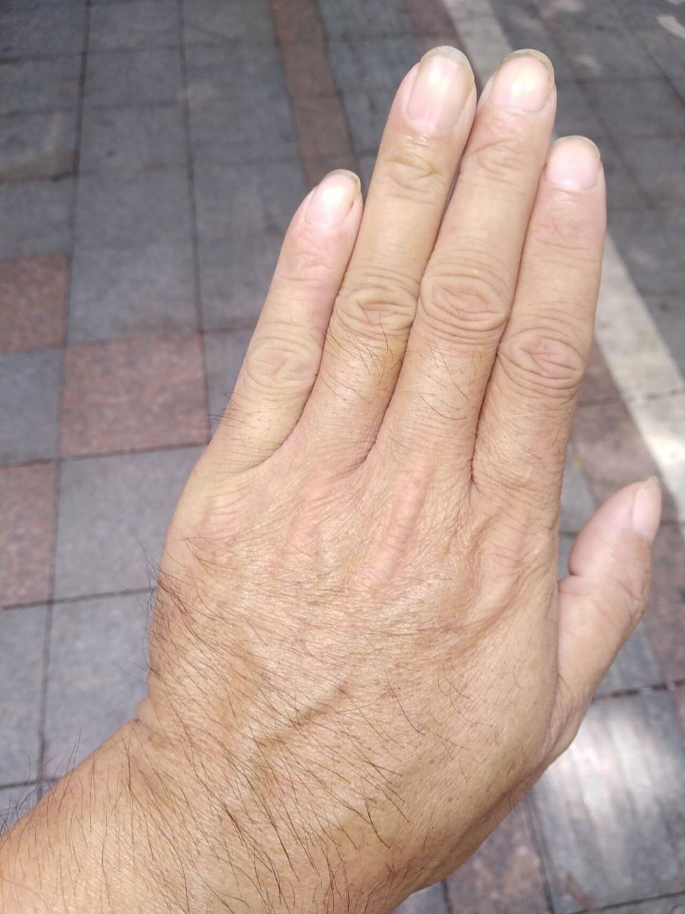 老人手皮肤也可以改变现在只剩下指关节皱纹 老人手的皮肤也是可以