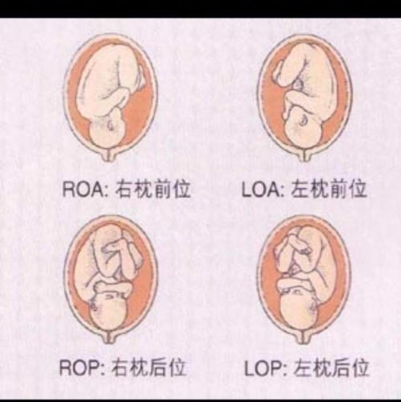 胎头着冠与拨露的图图片