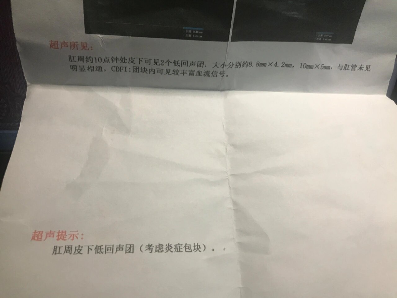 肛周脓肿彩超判定结果治疗方案 彩超判定肛周脓肿的方