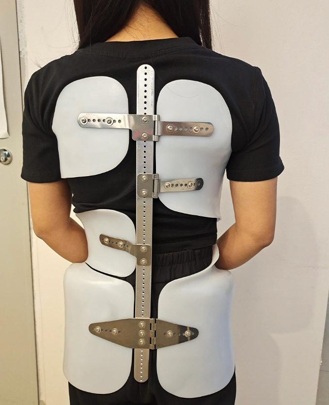 胸椎骨折保守治疗主要包括卧床休息,佩戴支具和药物治疗