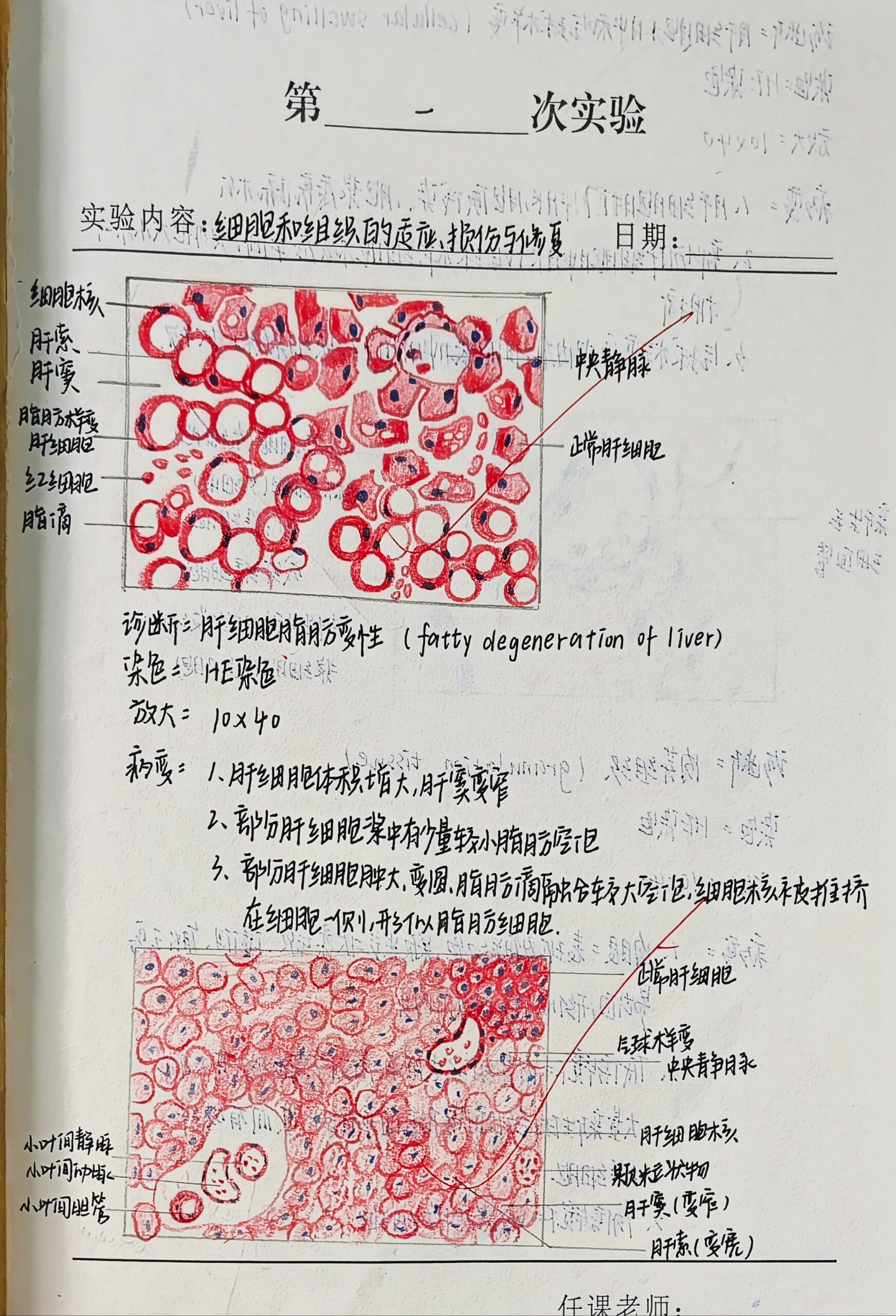 病理学 实验报告p1  肝细胞脂肪病变 肝细胞水肿和气球样变 肉芽组织