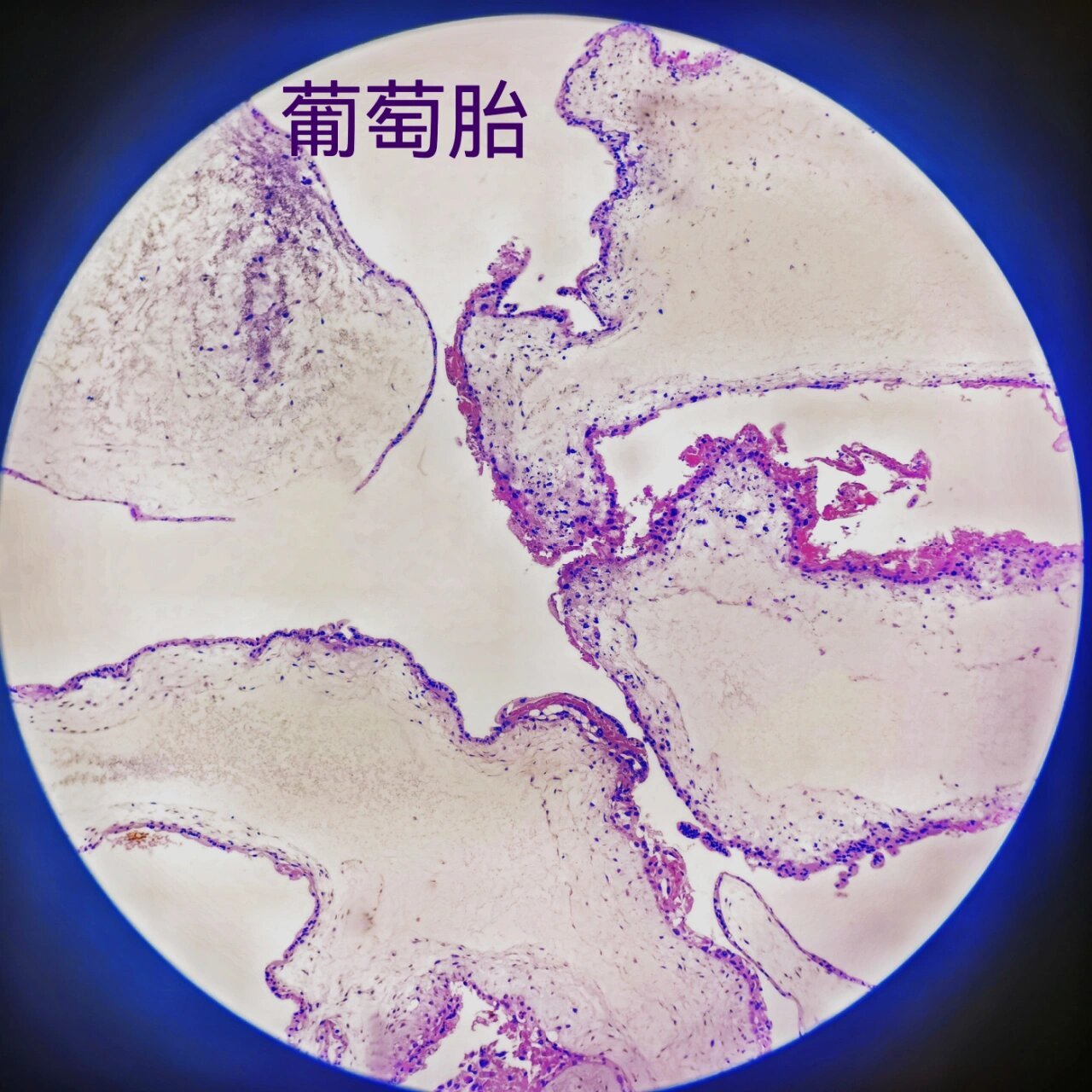 医学生笔记|病理切片观察(8)泌尿&升值      康康还有多少医学生没睡