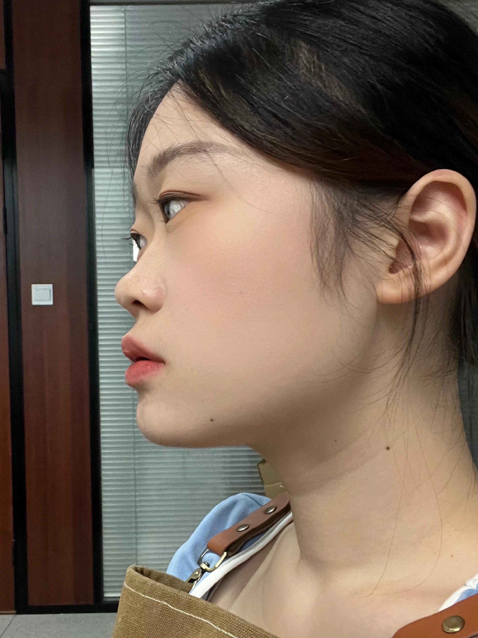 完全没有山根的侧脸