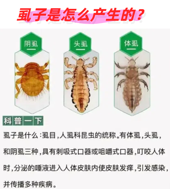 虱子是靠直接接触传播的寄生虫