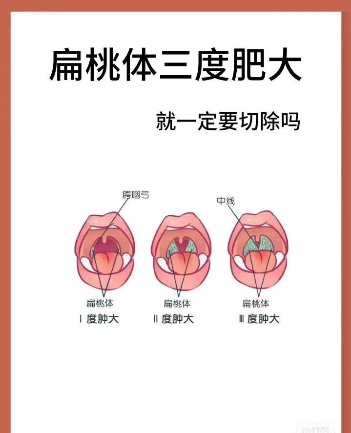 扁桃体长肉球图片图片