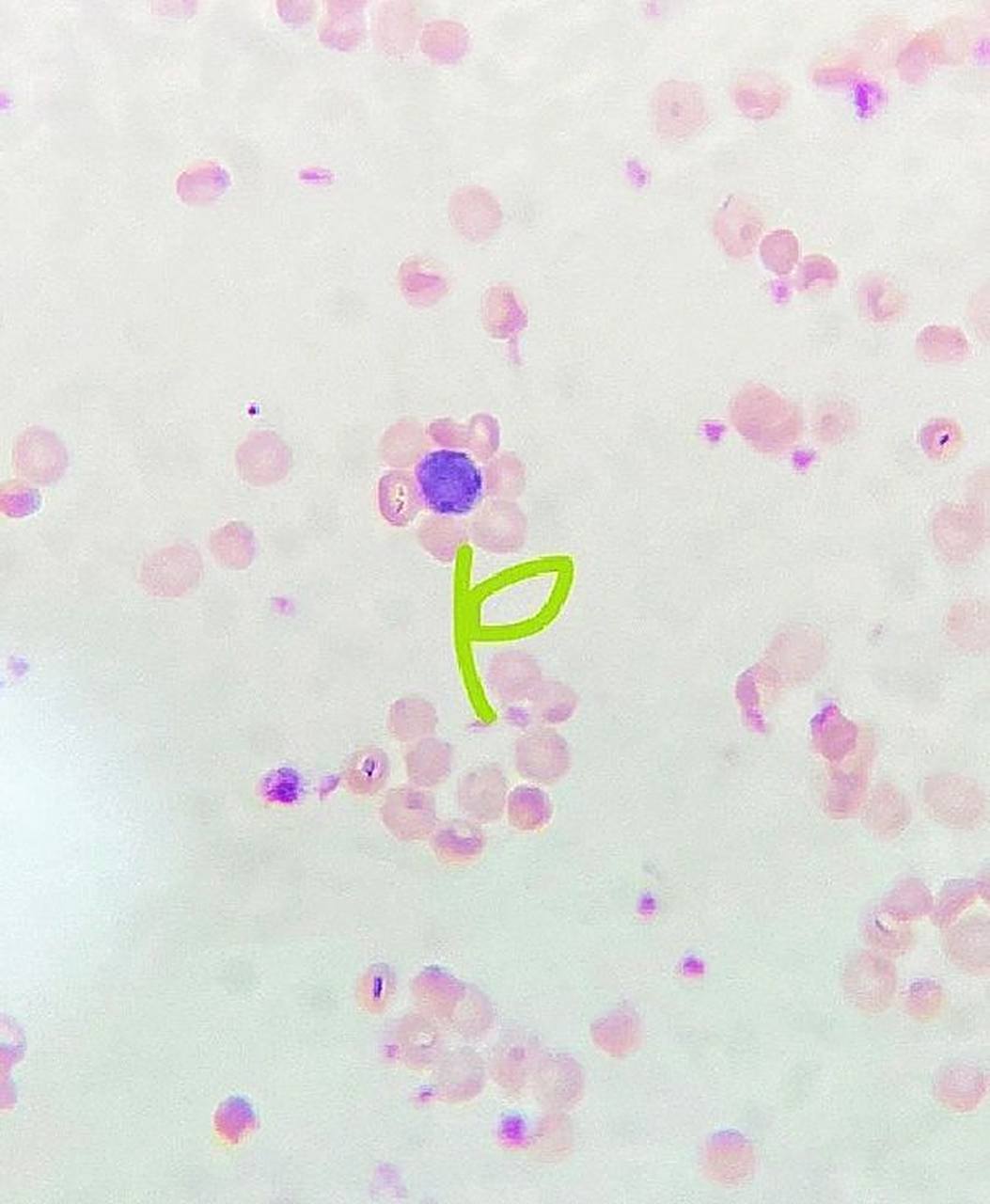 医学实验,e-玫瑰花环形成实验  e-玫瑰花环实验 有幸遇见一朵盛开的花