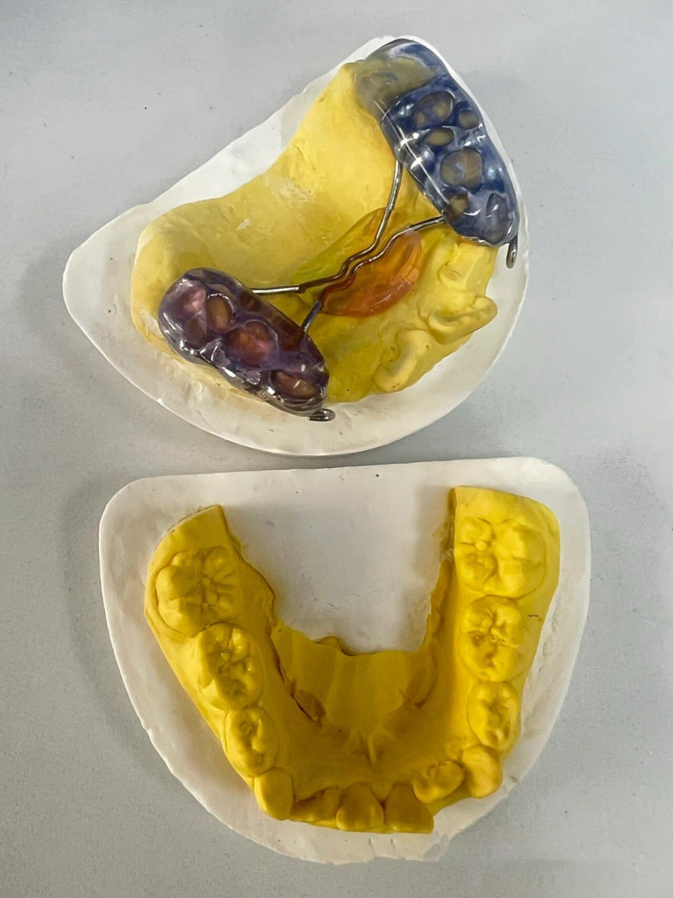 "地包天"前方牵引佩戴注意事项7515 1.