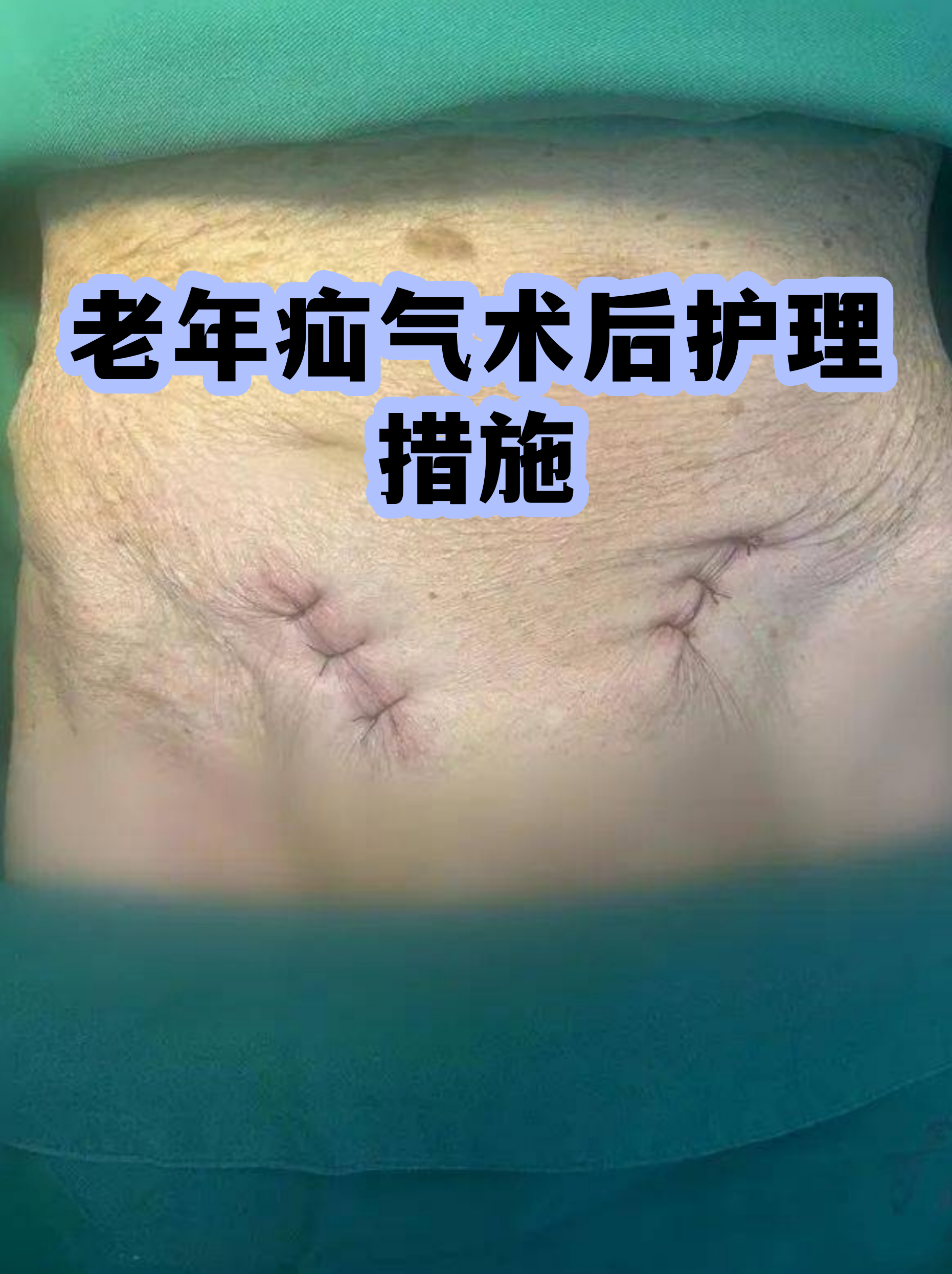 包含北京大学首钢医院住院办理陪诊挂号出院后注意事项讲解，居家恢复更科学的词条