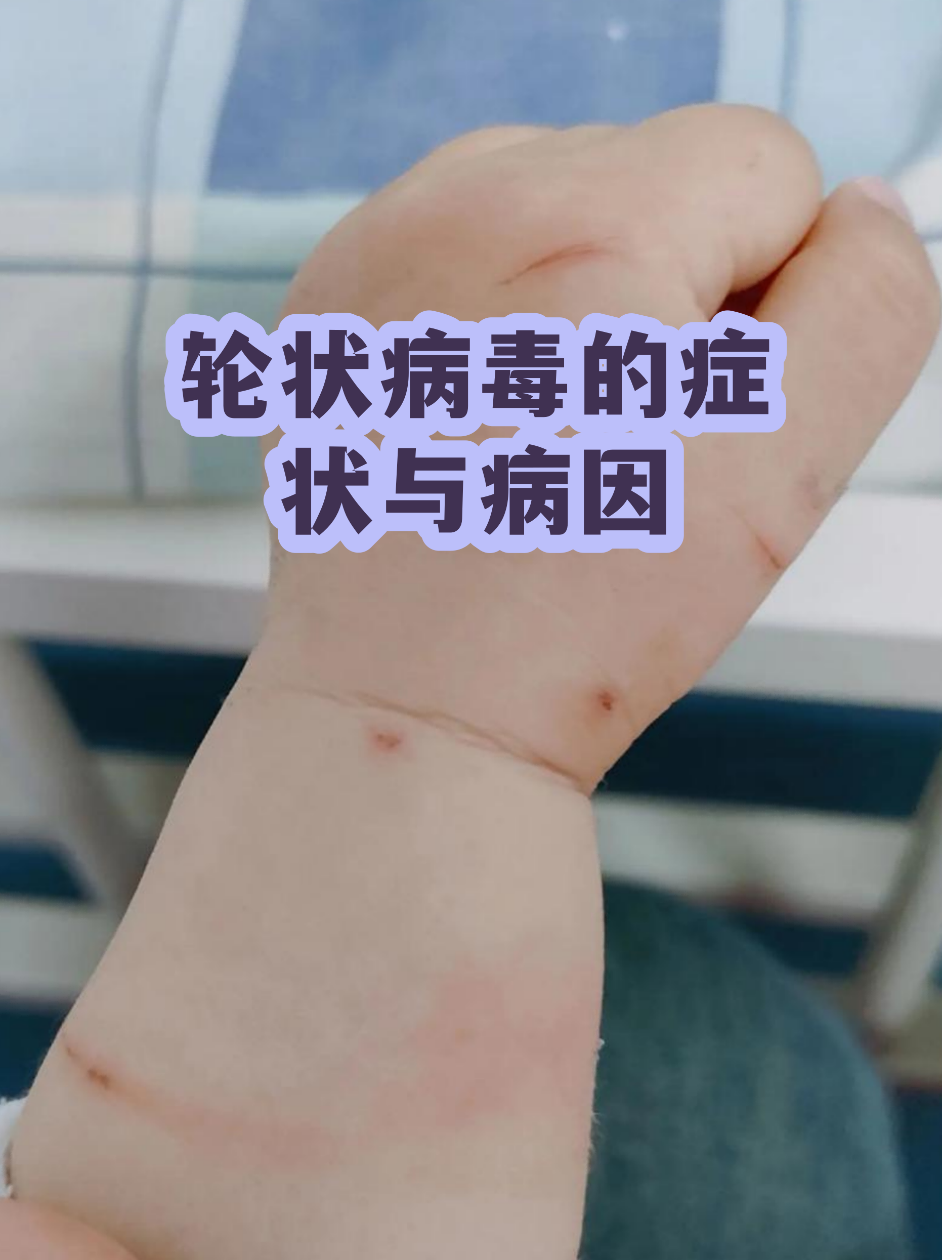  最近有什么病毒导致拉肚子的症状呢(最近流行的病毒拉肚子2020)
