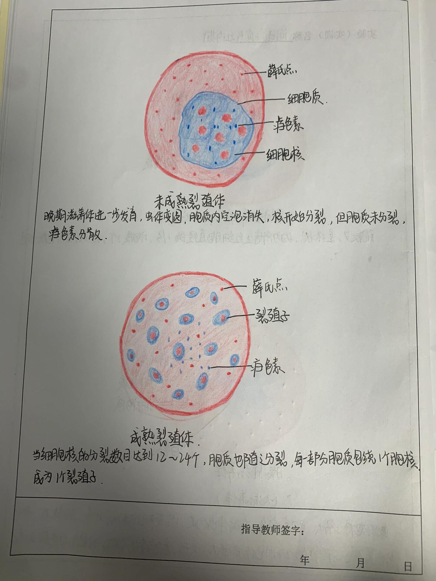 间日疟原虫红内期图片