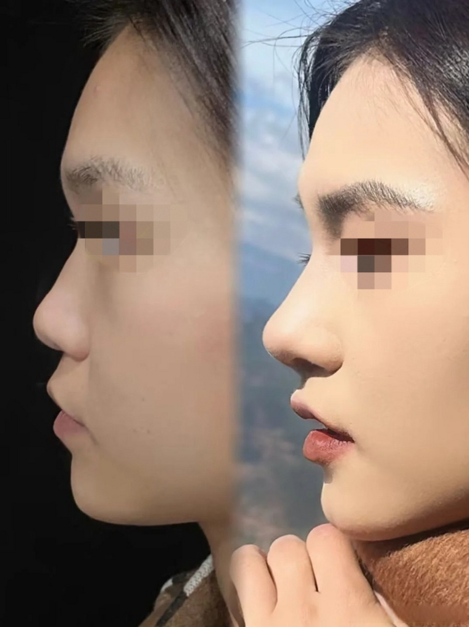 小翘鼻好看还是直鼻好看 哪种鼻子好看漂亮排行, 直鼻微翘适合拭创