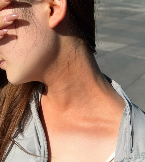 首先,紫外线照射会直接伤害皮肤