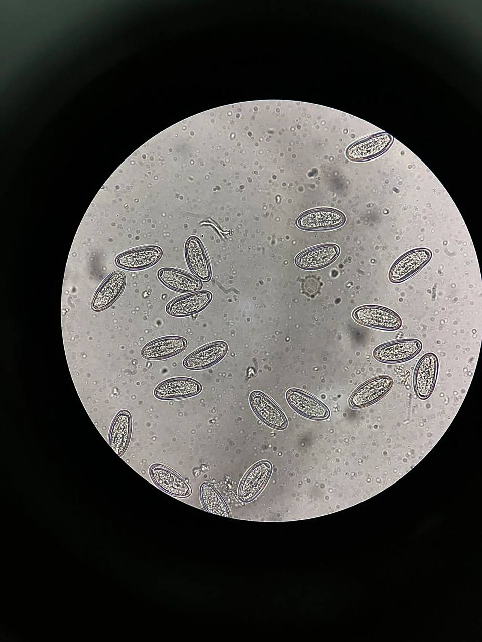 镜下蛲虫卵 第一次遇到,给大家激动坏了都不下班了挤在一起排队看哈哈