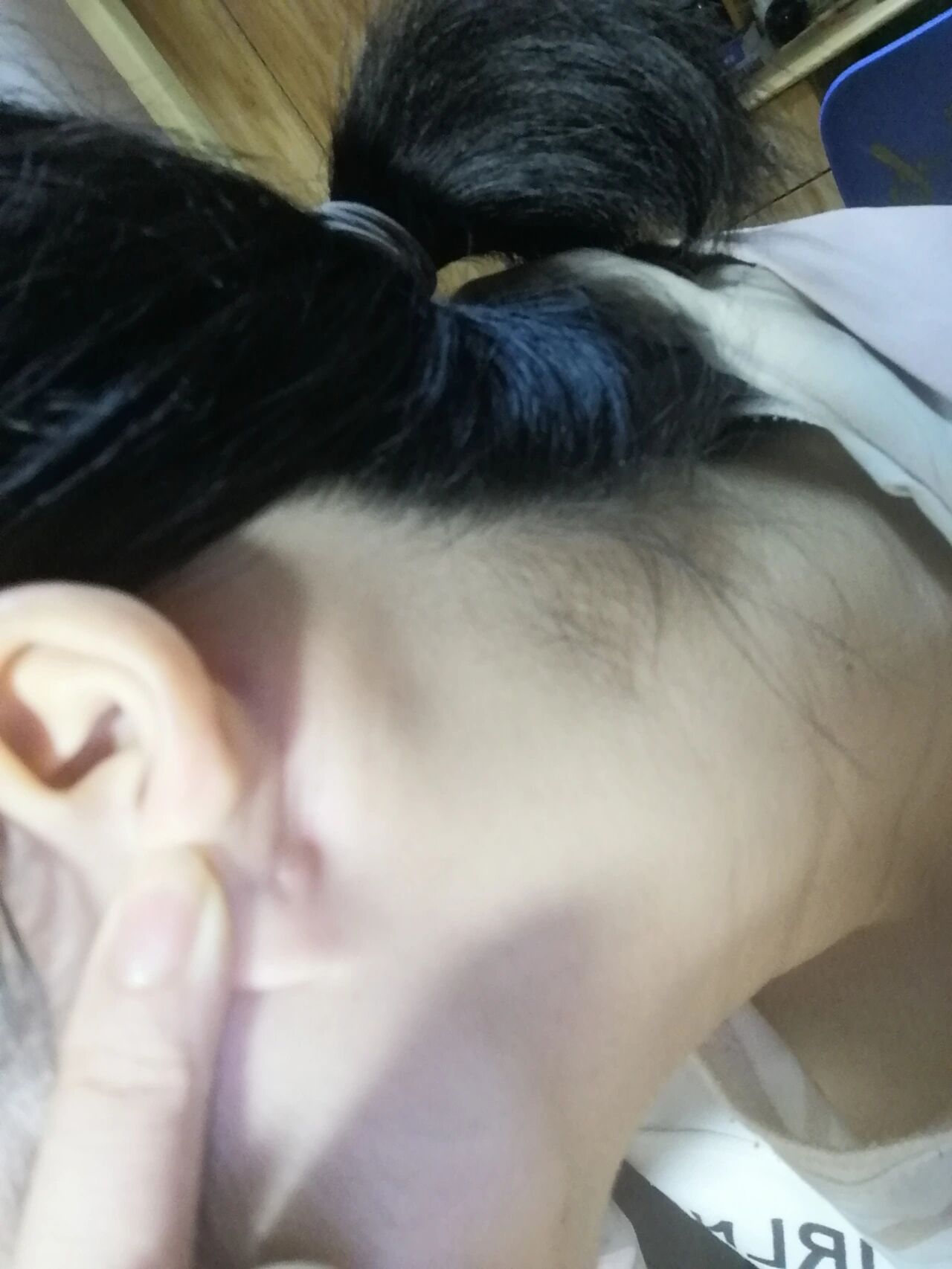 但从耳洞愈合后耳朵后面就时常长这种类似"瘤子"的东西 不痛不痒 就是