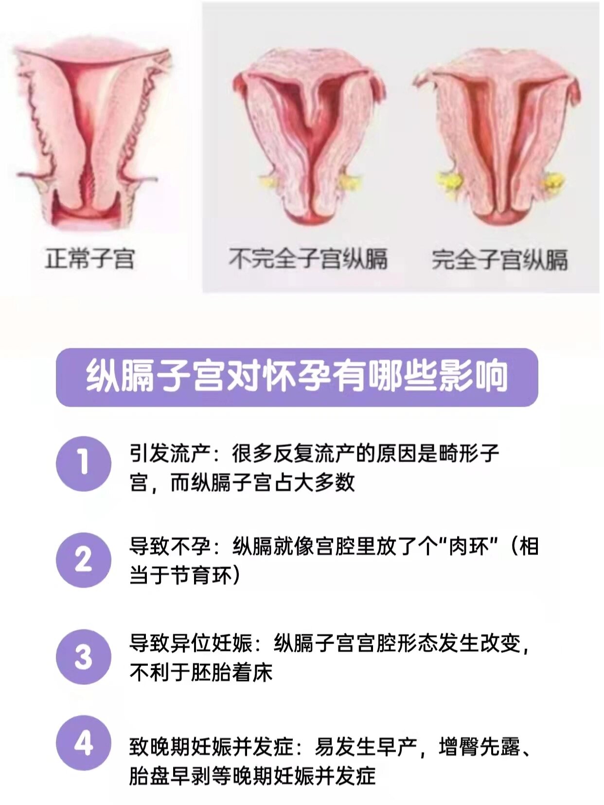 纵隔子宫能怀孕吗?有哪些影响?