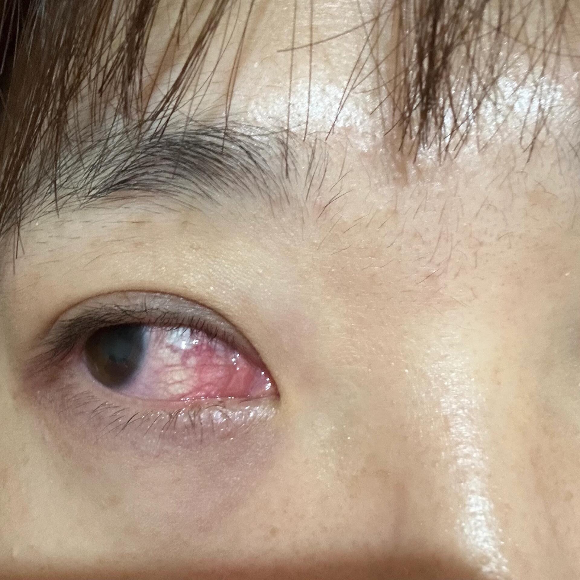 眼睛好痒什么原因啊?