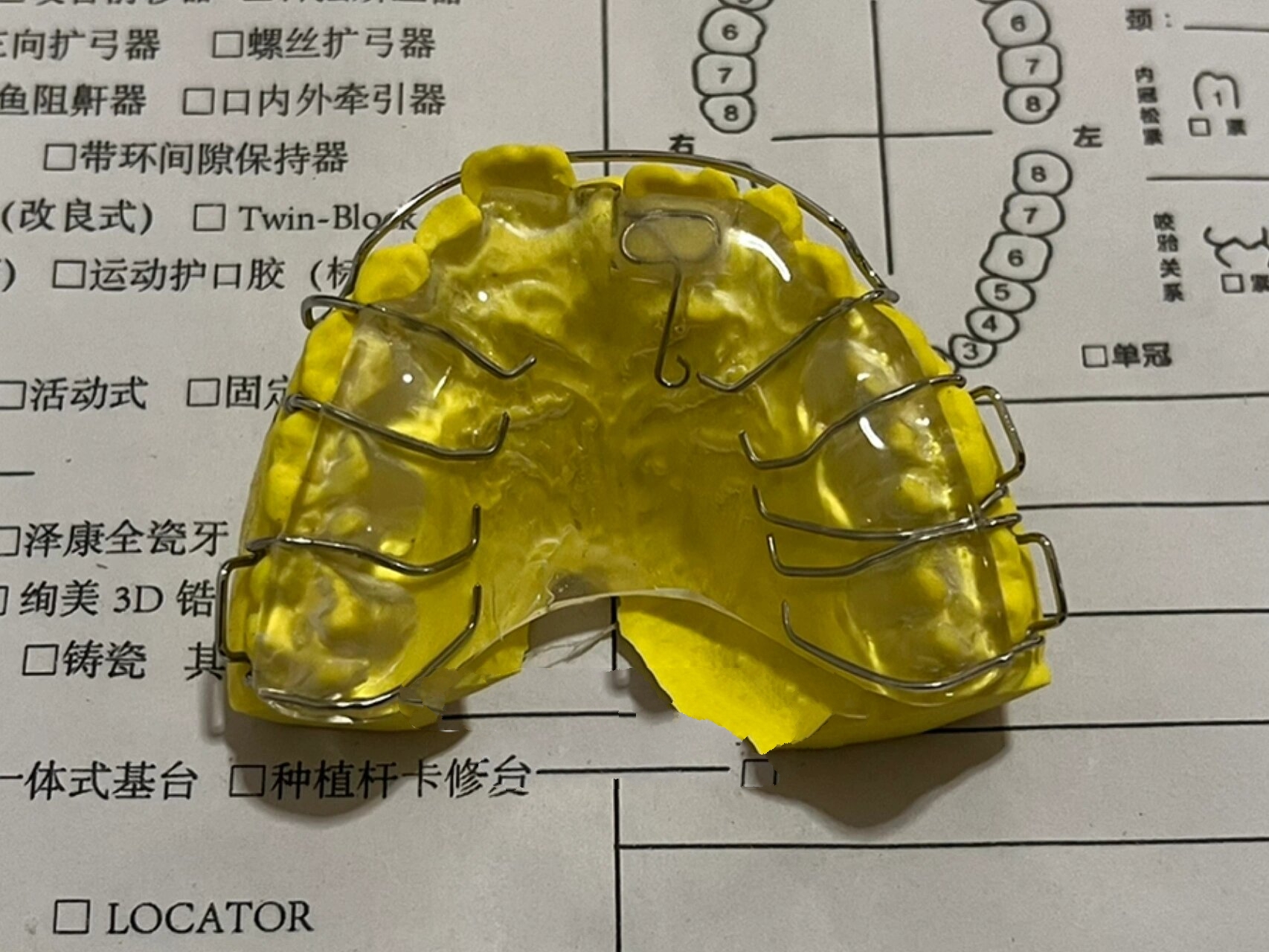 儿童地包天——反颌颌垫推簧矫治器7515