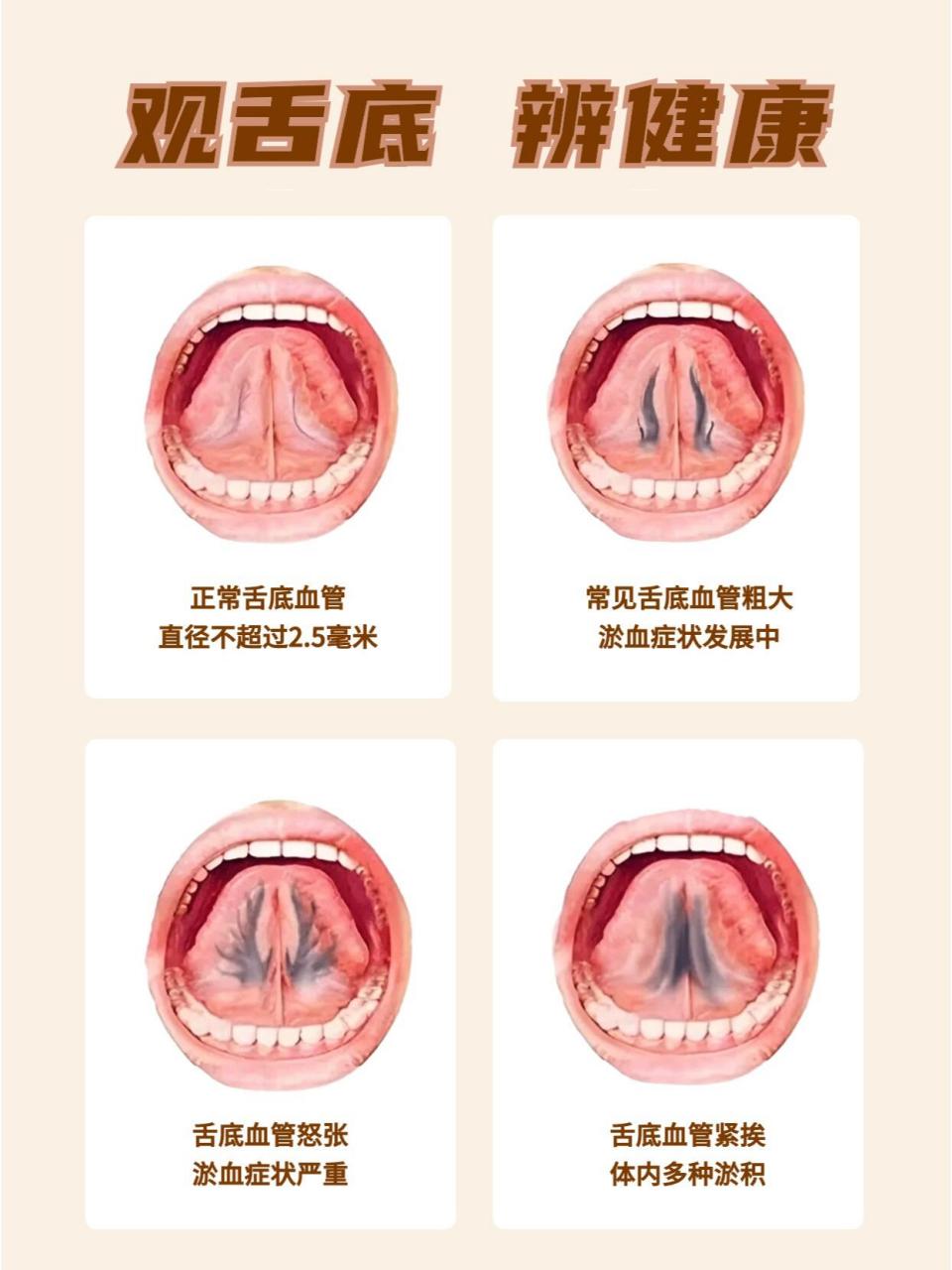 舌头构造真实示意图图片