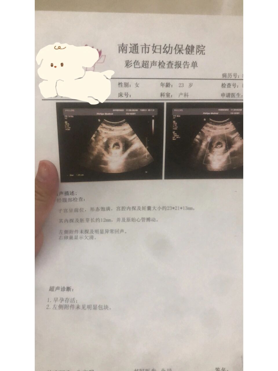 7天胚芽长了2mm正常吗 1号做的阴超 胚芽长10mm 隔七天做的涨了2mm