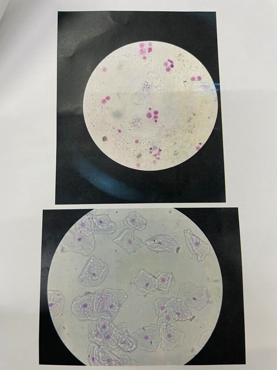 遗传学实验报告 实验一:x染色质标本的制备及分析