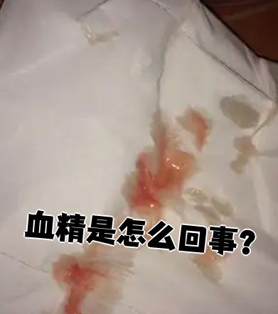 血精是指精液中带血,最常见的原因是尿道炎,前列腺炎或精囊炎