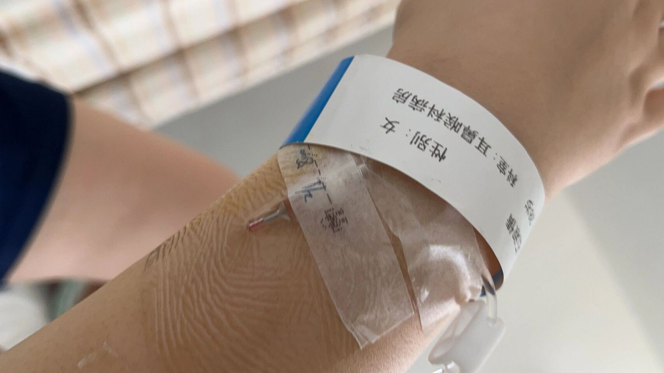 会厌囊肿术后流食期中… 会厌囊肿手术已经完成73 下面来介绍一下我