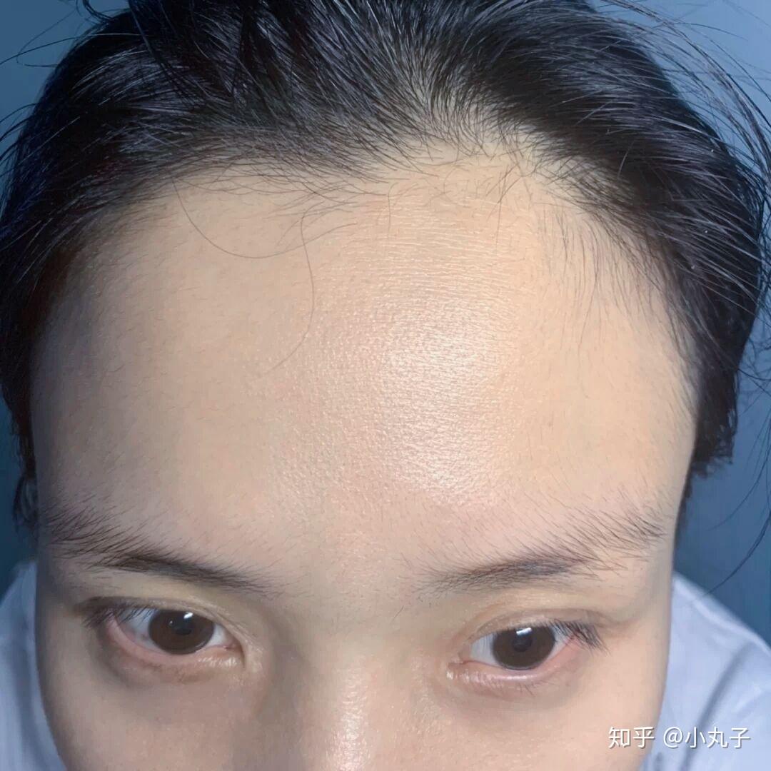 怎么弄出鞠婧祎这种的发际线的胎毛