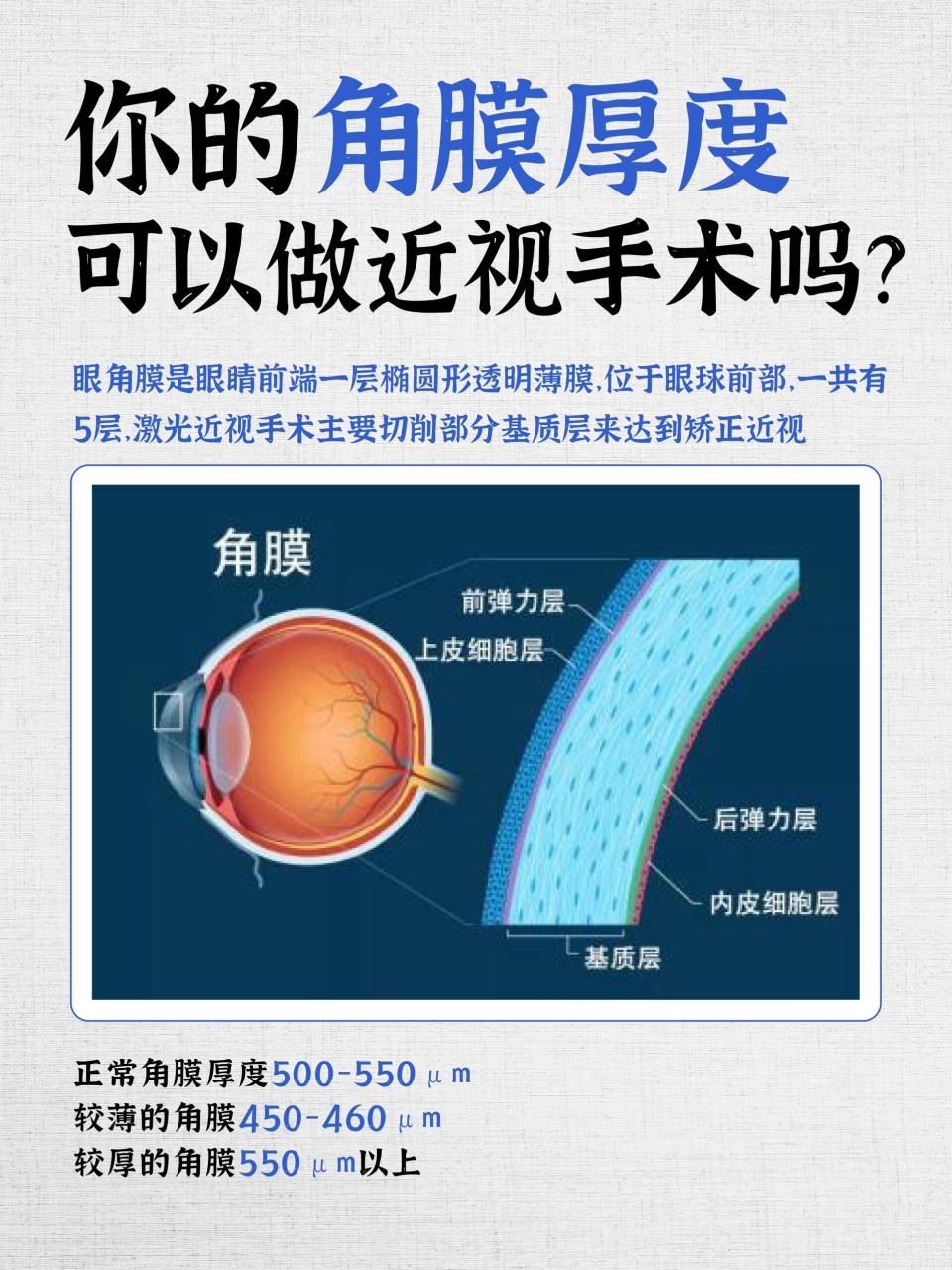 73正常角膜厚度在500~550 μm 73较薄角膜在450~460 μm 73较