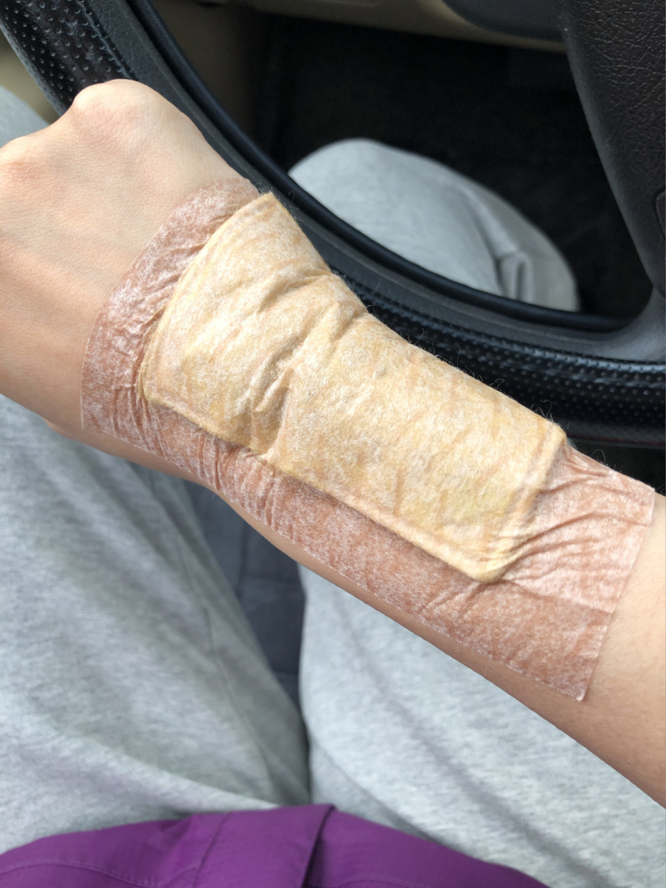 现已痊愈 982021年4月23日,右手腕外侧开始疼,是扭筋的那种疼,无论