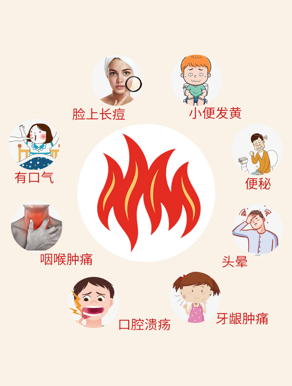 火"分实热症和虚热症,长期经常口腔溃疡,口干口苦,咽炎,痘痘,便秘