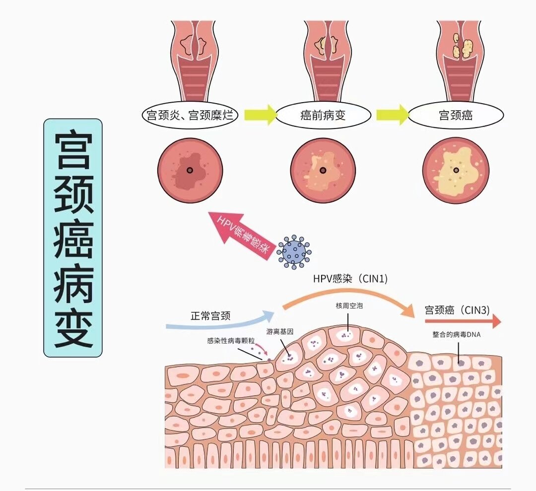 了解子宫内部构造 女性生殖健康养护很重要