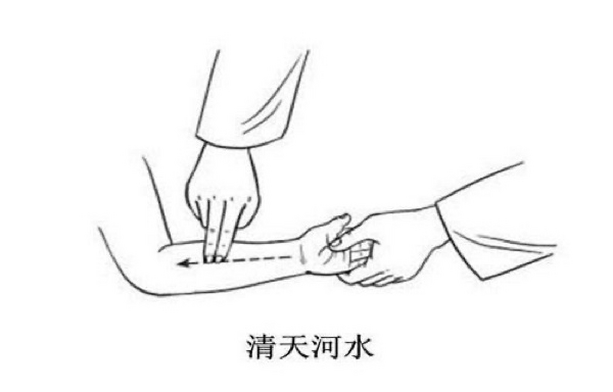 小儿退烧-清天河水 天河水退烧手法 1,取天河水: 从肘推至腕,推法100