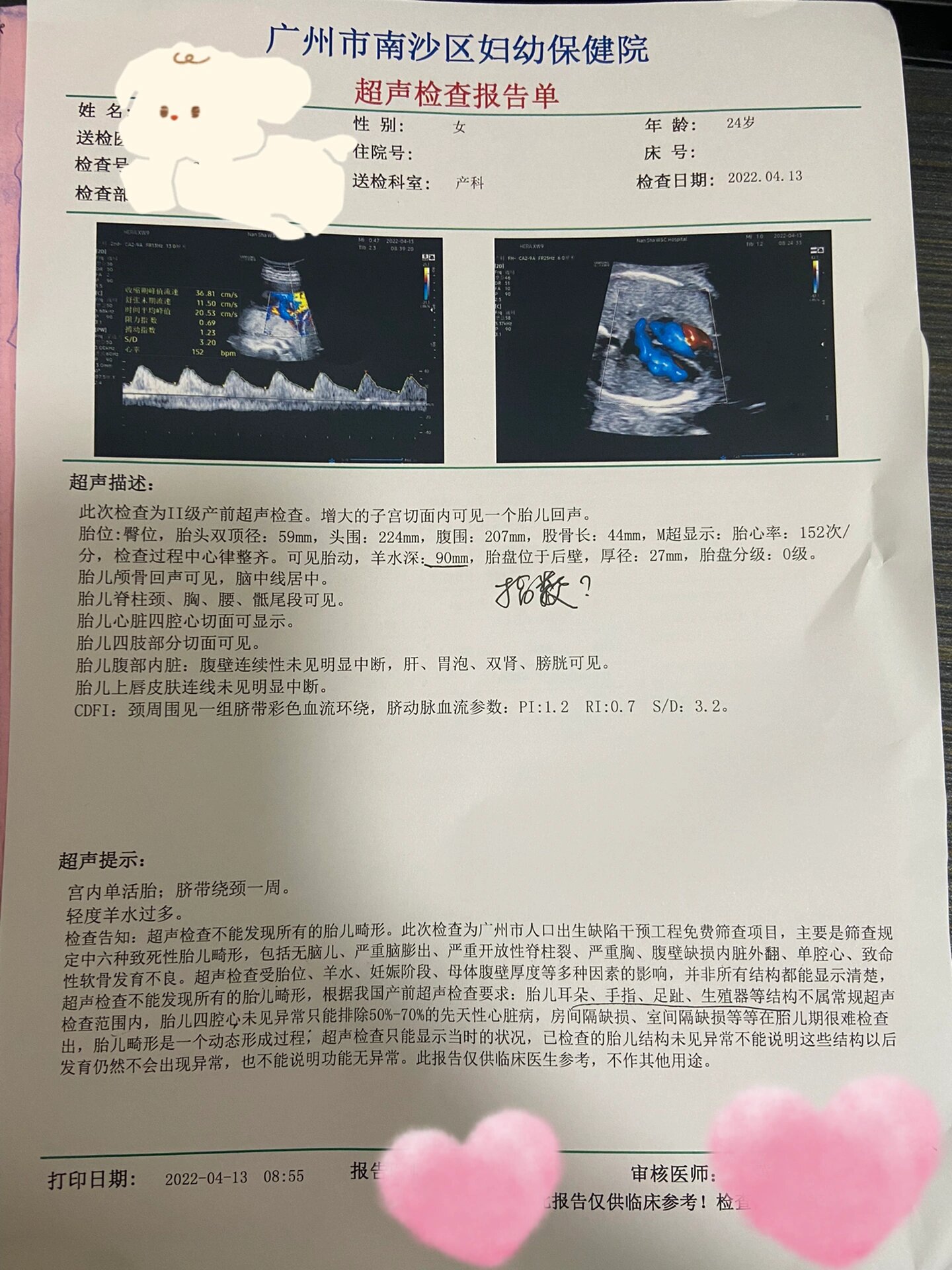 孕24周大排畸羊水偏多怎么办010101 昨天去做了大排畸二维检查